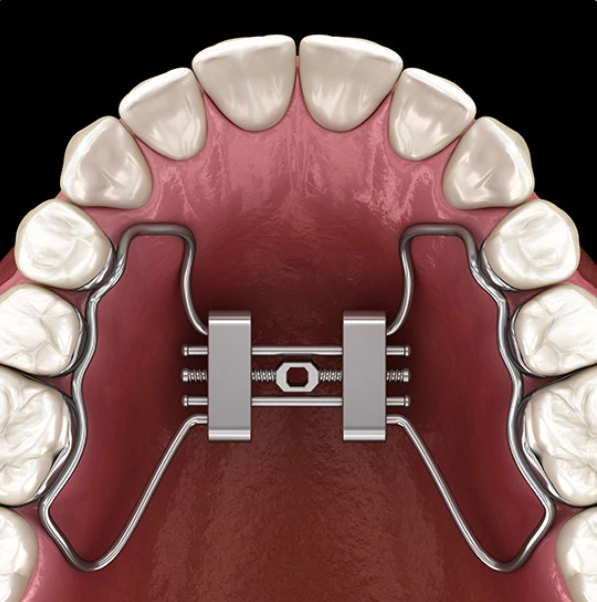 Class Iii Reverse Pull Facemask